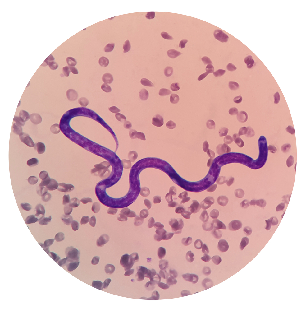 Microscopic blood smear showing microfilariae — heartworm disease diagnosis in dogs