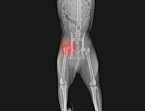 Why Do Different Hip Problems Lead to Different Surgeries?